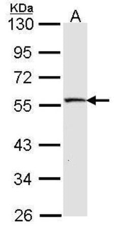 Invitrogen MST4 Polyclonal Antibody 100 &mu;L; Unconjugated:Antibodies,