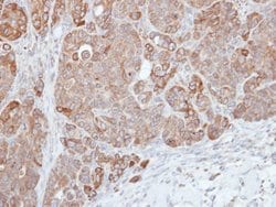 Invitrogen HPS3 Polyclonal Antibody 100 &mu;L | Buy Online | Invitrogen&trade; | Fisher Scientific