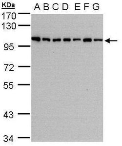 Invitrogen HPS3 Polyclonal Antibody 100 &mu;L | Buy Online | Invitrogen&trade; | Fisher Scientific