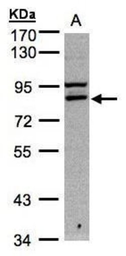 Invitrogen FASTKD1 Polyclonal Antibody 100 &mu;L | Buy Online | Invitrogen&trade; | Fisher Scientific