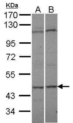 Invitrogen Adenylate Kinase 8 Polyclonal Antibody 100 &mu;L; Unconjugated:Antibodies,