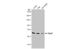 Invitrogen DYRK3 Polyclonal Antibody 100 &mu;L; Unconjugated:Antibodies,