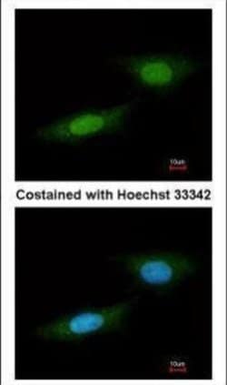Invitrogen NLK Polyclonal Antibody 100 &mu;L; Unconjugated:Antibodies,