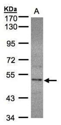 Invitrogen SEPHS2 Polyclonal Antibody 100 &mu;L; Unconjugated:Antibodies,
