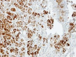 Invitrogen Importin 13 Polyclonal Antibody 100 &mu;L; Unconjugated:Antibodies,