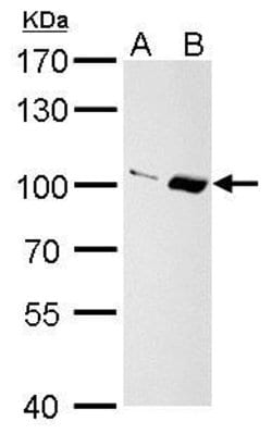 Invitrogen Importin 13 Polyclonal Antibody 100 &mu;L; Unconjugated:Antibodies,