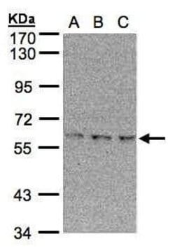 Invitrogen EPM2AIP1 Polyclonal Antibody 100 &mu;L; Unconjugated:Antibodies,