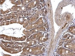 Invitrogen ETEA Polyclonal Antibody 100 &mu;L; Unconjugated:Antibodies,