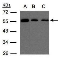 Invitrogen ORP2 Polyclonal Antibody 100 &mu;L; Unconjugated:Antibodies,