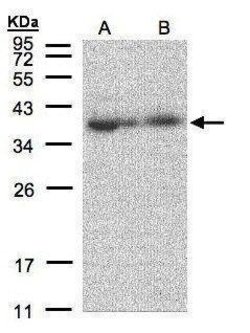 Invitrogen MRPL3 Polyclonal Antibody 100 &mu;L; Unconjugated:Antibodies,
