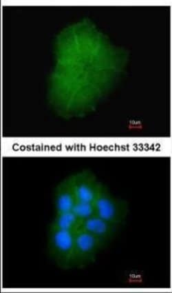 Invitrogen TMEM147 Polyclonal Antibody 100 &mu;L | Buy Online | Invitrogen&trade; | Fisher Scientific