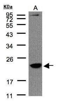 Invitrogen TMEM147 Polyclonal Antibody 100 &mu;L | Buy Online | Invitrogen&trade; | Fisher Scientific