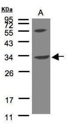 VPS37C Polyclonal Antibody, Invitrogen 100 &mu;L; Unconjugated:Antibodies,
