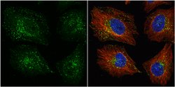 Invitrogen VPS35 Polyclonal Antibody 100 &mu;L; Unconjugated:Antibodies,