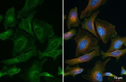 Invitrogen VPS35 Polyclonal Antibody 100 &mu;L; Unconjugated:Antibodies,