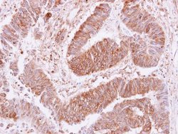 Invitrogen VPS35 Polyclonal Antibody 100 &mu;L; Unconjugated:Antibodies,