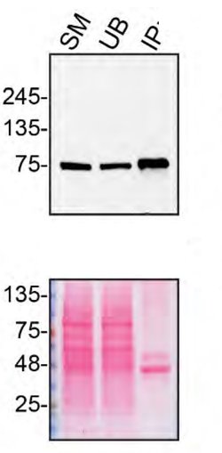 Invitrogen VPS35 Polyclonal Antibody 100 &mu;L; Unconjugated:Antibodies,