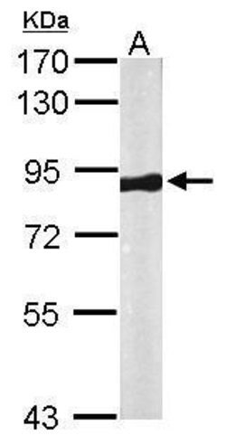 Invitrogen VPS35 Polyclonal Antibody 100 &mu;L; Unconjugated:Antibodies,