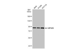 Invitrogen VPS35 Polyclonal Antibody 100 &mu;L; Unconjugated:Antibodies,