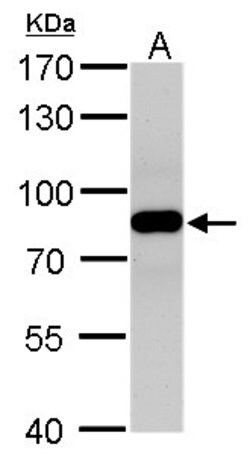 Invitrogen VPS35 Polyclonal Antibody 100 &mu;L; Unconjugated:Antibodies,