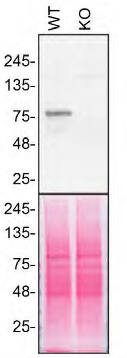 Invitrogen VPS35 Polyclonal Antibody 100 &mu;L; Unconjugated:Antibodies,