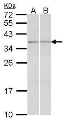 Invitrogen TGIF2 Polyclonal Antibody 100 μL; Unconjugated:Antibodies,