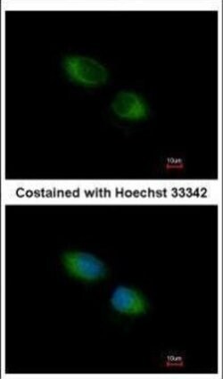 Invitrogen TMX Polyclonal Antibody 100 &mu;L; Unconjugated:Antibodies,