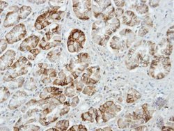 Invitrogen Munc13-4 Polyclonal Antibody 100 &mu;L | Buy Online | Invitrogen&trade; | Fisher Scientific