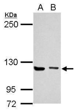 Invitrogen Munc13-4 Polyclonal Antibody 100 &mu;L | Buy Online | Invitrogen&trade; | Fisher Scientific