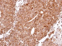 HRH2 Polyclonal Antibody, Invitrogen 100 &mu;L; Unconjugated:Antibodies,