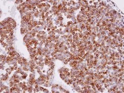 Invitrogen XPR1 Polyclonal Antibody 100 μL; Unconjugated:Antibodies,