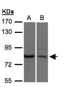 Invitrogen XPR1 Polyclonal Antibody 100 μL; Unconjugated:Antibodies,