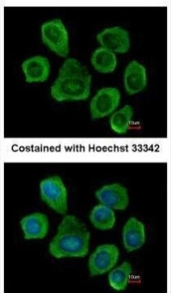 Invitrogen PTGFRN Polyclonal Antibody 100 &mu;L; Unconjugated:Antibodies,