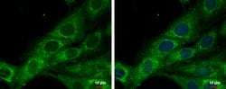 Invitrogen COX6A2 Polyclonal Antibody 100 &mu;L; Unconjugated:Antibodies,