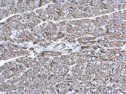 Invitrogen COX6A2 Polyclonal Antibody 100 &mu;L; Unconjugated:Antibodies,