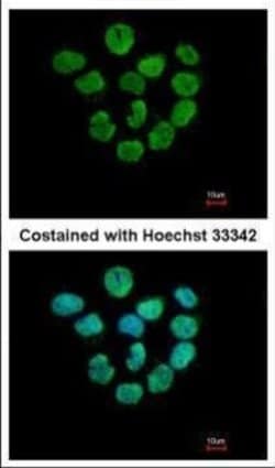 Invitrogen Histone H2A.Z Polyclonal Antibody 100 &mu;L; Unconjugated:Antibodies,