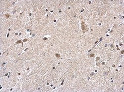 Invitrogen Histone H2A.Z Polyclonal Antibody 100 &mu;L; Unconjugated:Antibodies,