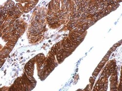 Invitrogen Thrombomodulin Polyclonal Antibody 100 &mu;L; Unconjugated:Antibodies,