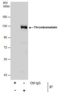 Invitrogen Thrombomodulin Polyclonal Antibody 100 &mu;L; Unconjugated:Antibodies,
