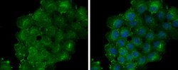 Invitrogen Thrombomodulin Polyclonal Antibody 100 &mu;L; Unconjugated:Antibodies,