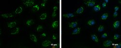 Invitrogen TIM17 Polyclonal Antibody 100 &mu;L; Unconjugated:Antibodies,