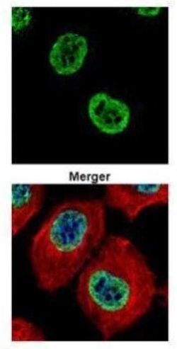 Invitrogen Histone H2A.Z Polyclonal Antibody 100 &mu;L; Unconjugated:Antibodies,