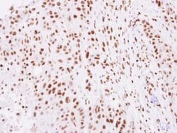 Invitrogen Histone H2A.Z Polyclonal Antibody 100 &mu;L; Unconjugated:Antibodies,