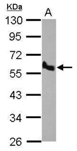 Invitrogen BMP-10 Polyclonal Antibody 100 &mu;L; Unconjugated:Antibodies,