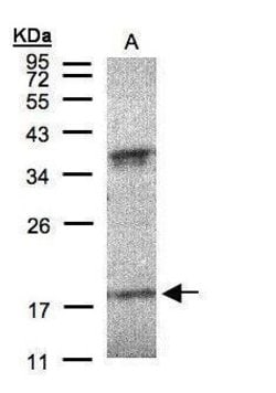 Invitrogen Interferon alpha-6 Polyclonal Antibody 100 &mu;L; Unconjugated:Antibodies,