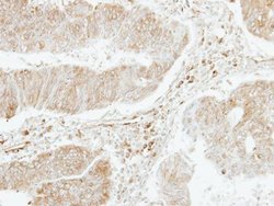 Invitrogen PF4V1 Polyclonal Antibody 100 &mu;L; Unconjugated:Antibodies,