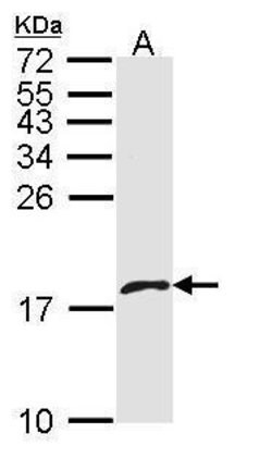 Invitrogen PF4V1 Polyclonal Antibody 100 &mu;L; Unconjugated:Antibodies,