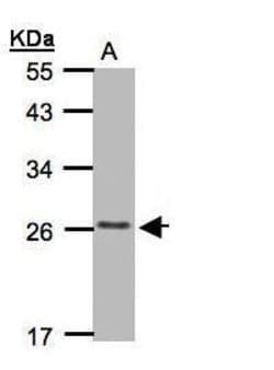 Invitrogen CMTM5 Polyclonal Antibody 100 μL; Unconjugated:Antibodies,