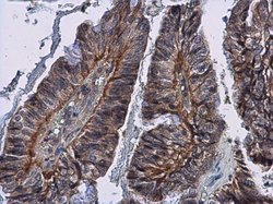 IL24 Polyclonal Antibody, Invitrogen 100 μL; Unconjugated:Antibodies,