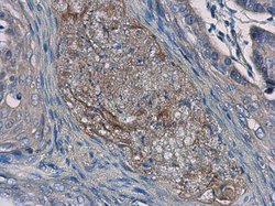 IL24 Polyclonal Antibody, Invitrogen 100 μL; Unconjugated:Antibodies,